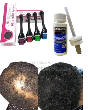 Kirkland Hair Growth Kit With Derma Roller – Fast Results