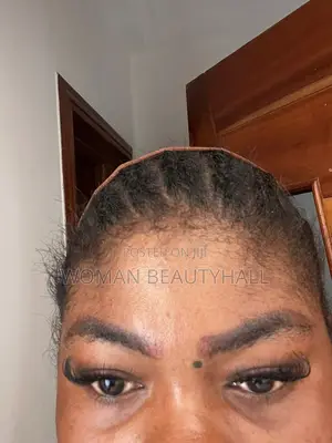 Laser Brows Removal