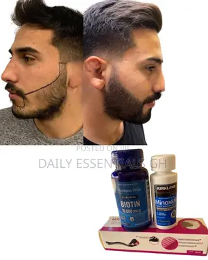 Kirkland Foam + Biotin + Roller – Hair Restoration Combo