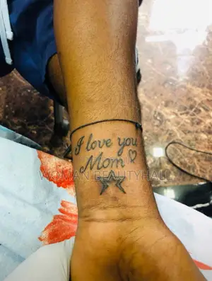 Tattoo Removal