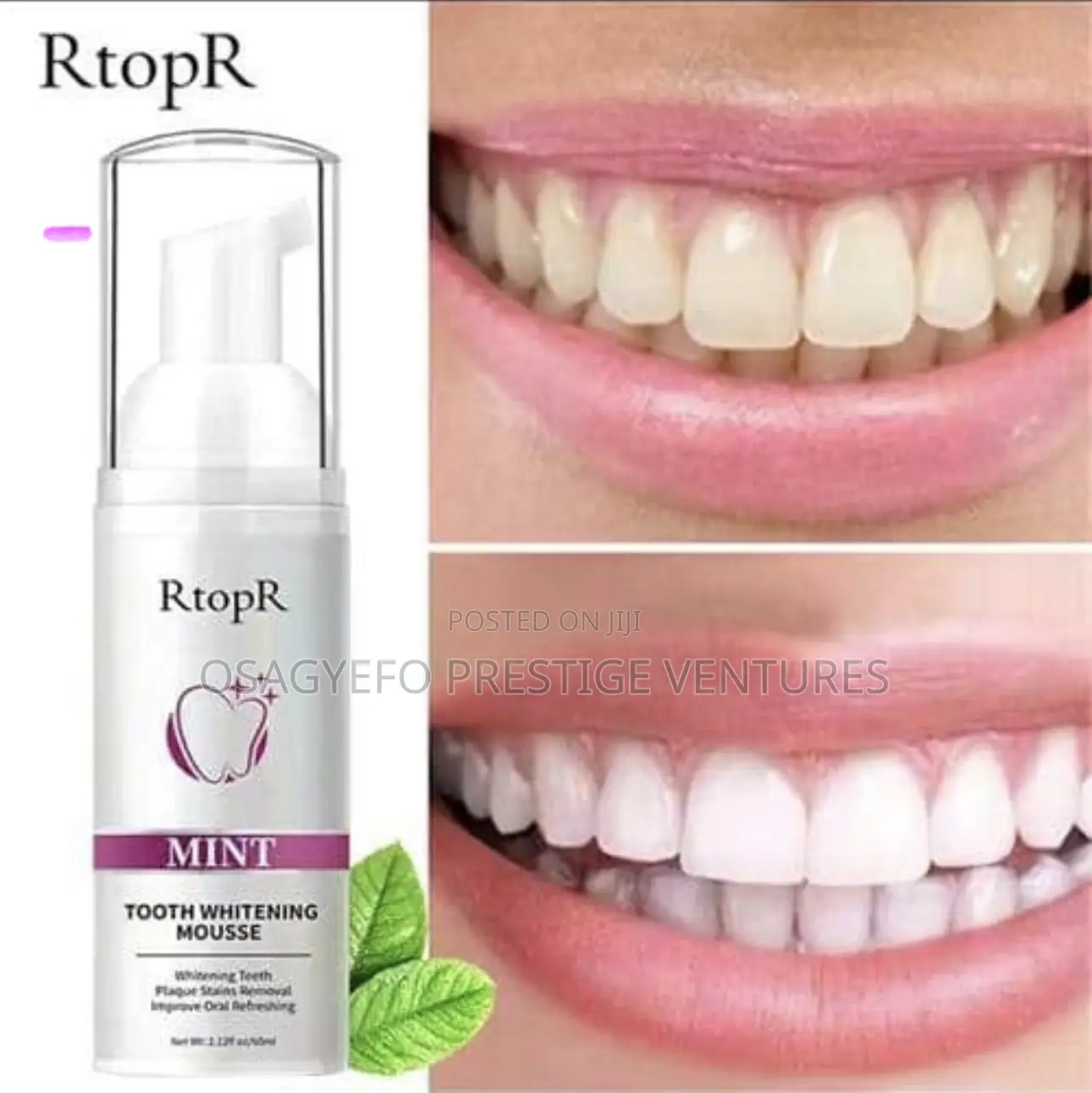Quality Teeth Whitening Mousse