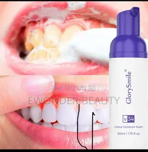 Teeth Whitening