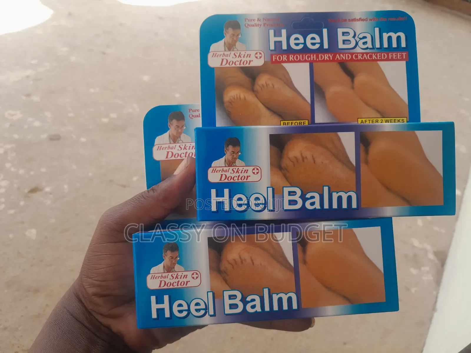 Heel Balm for Dry and Cracked Heels