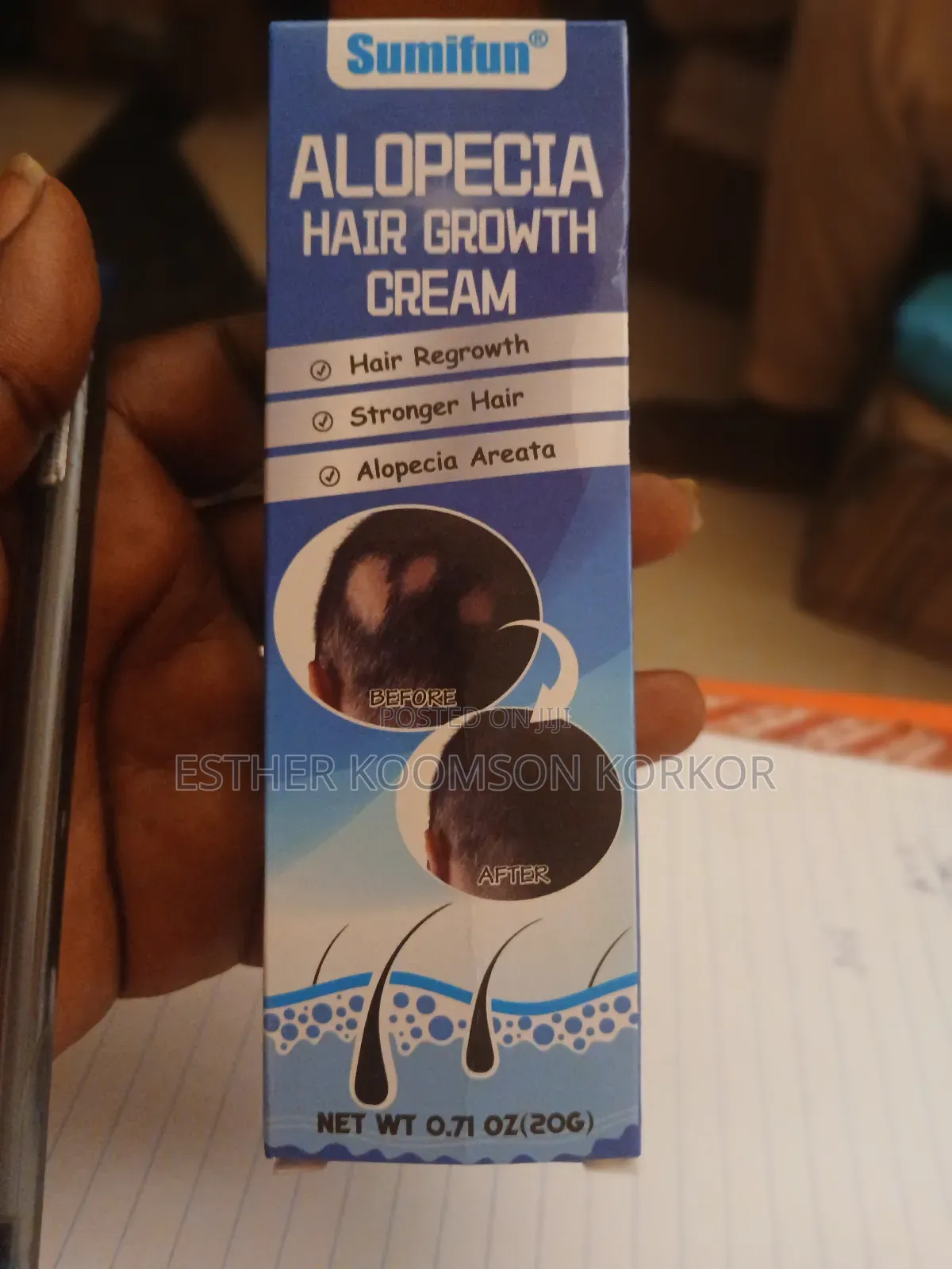 Alopecia Hair Growth Cream