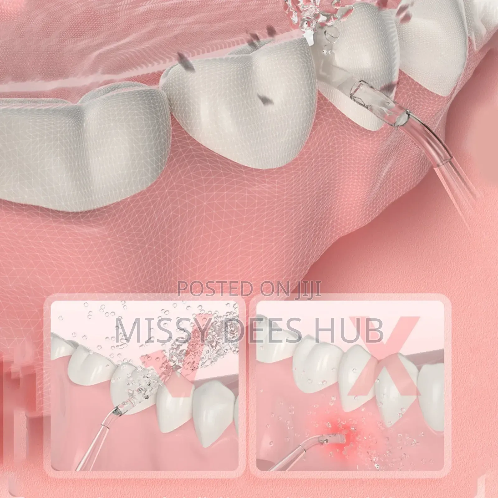 Oral Irrigator/ Water Flosser