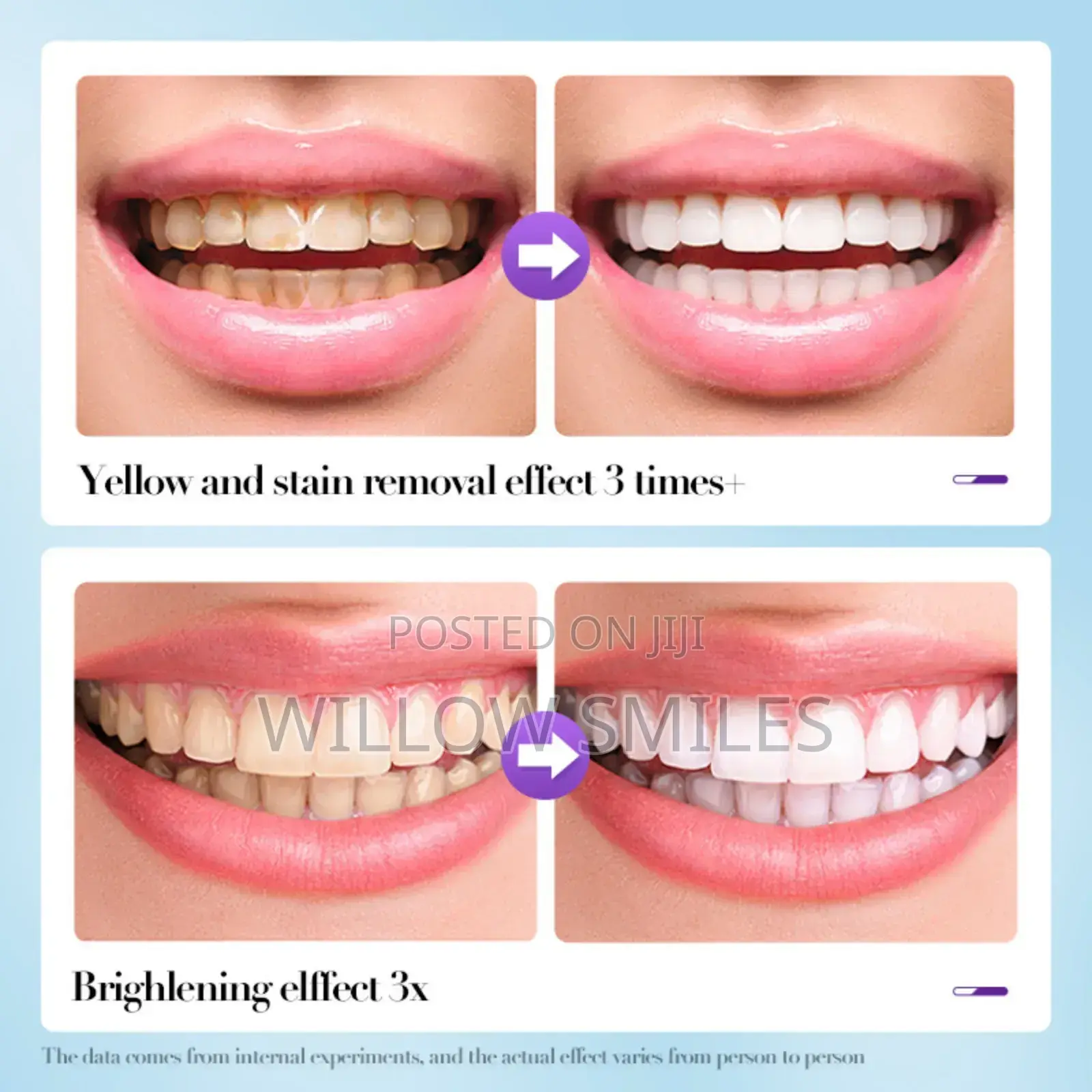 V34 Teeth Whitening Powder