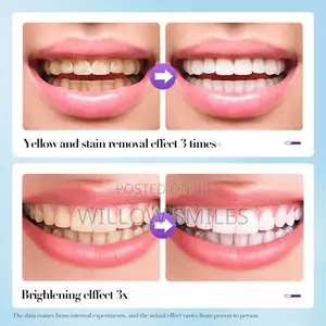 V34 Teeth Whitening Powder