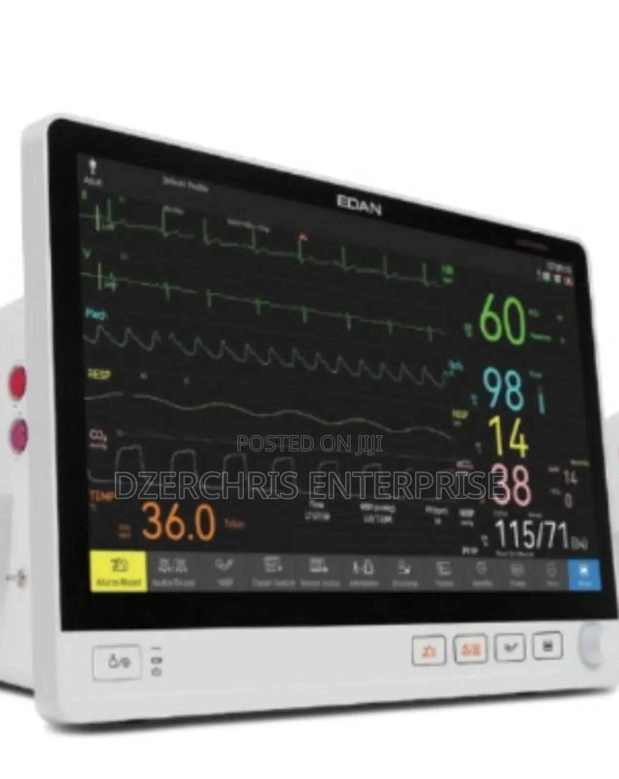 Edan Ux Series Patient Monitor