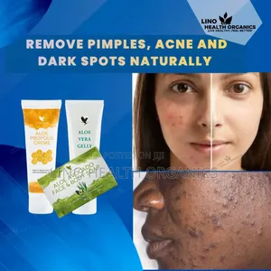 Pimples, Acne and Dark Spots Removal Pak