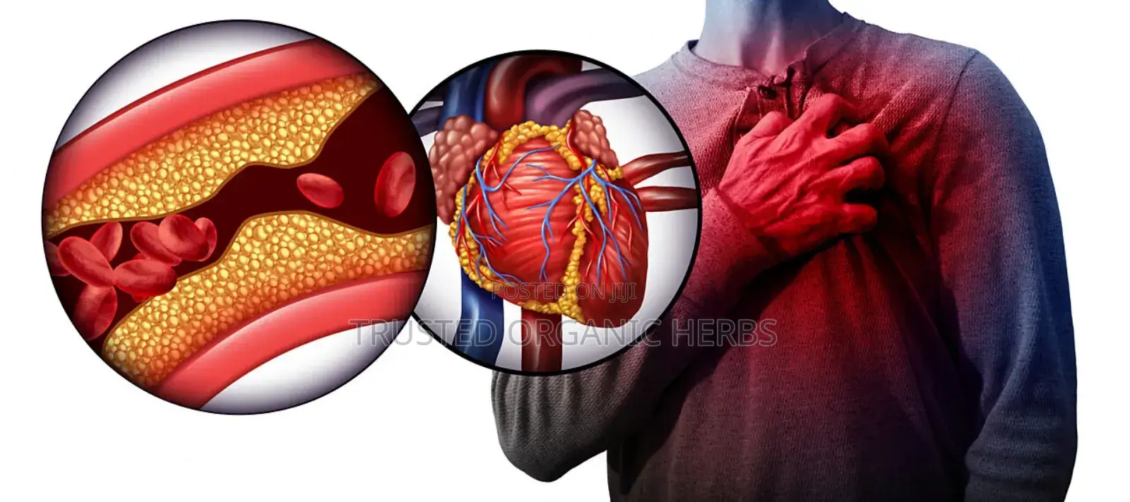 Heart Attack Stroke Remedy
