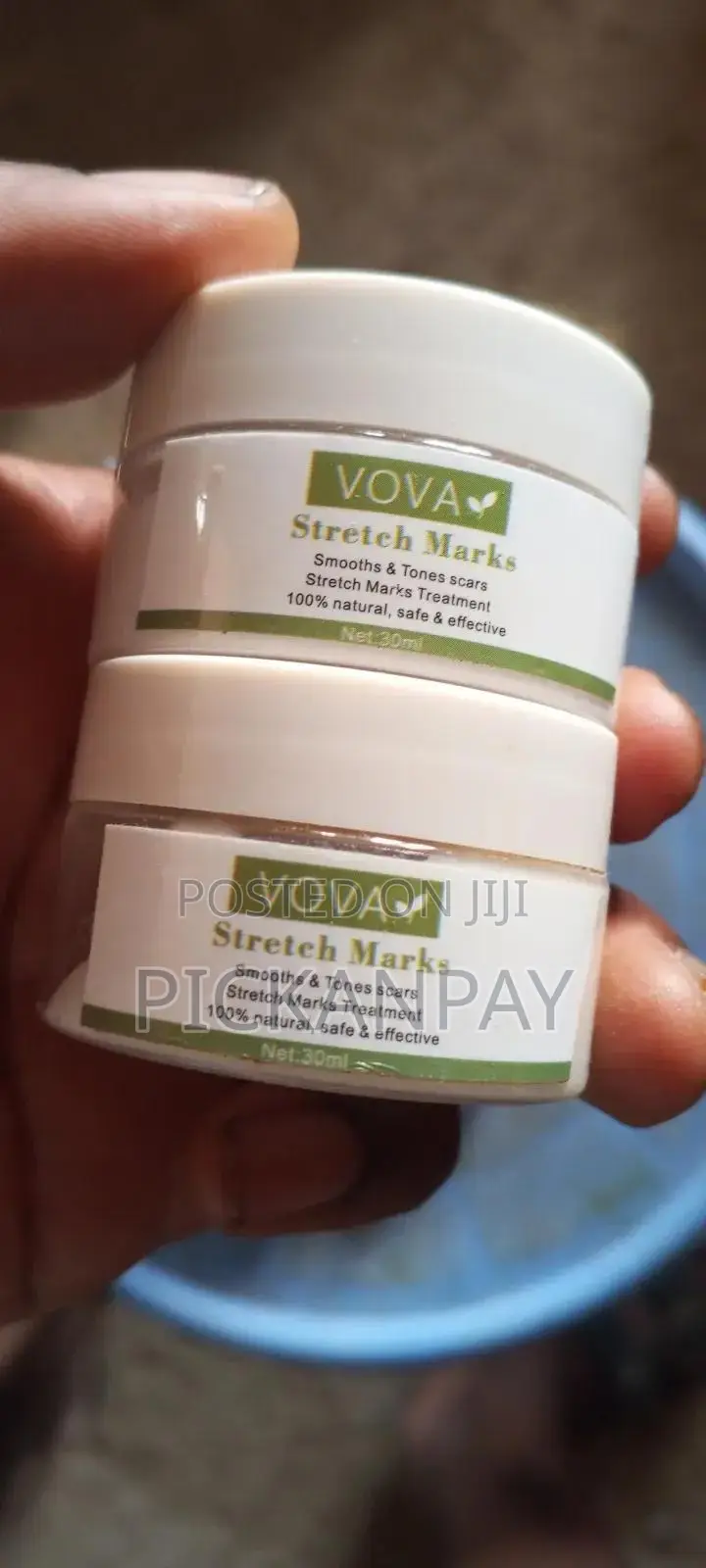 Stretch Mark Cream and Oil