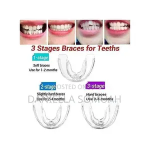 Teeth Aligners, Invisible Braces