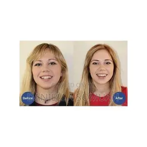 Teeth Aligners, Invisible Braces
