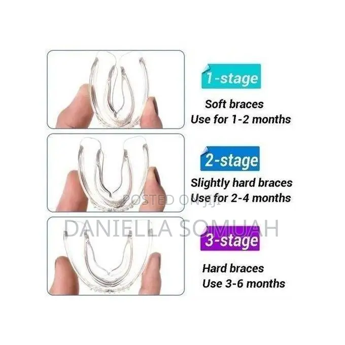 Teeth Aligners, Invisible Braces