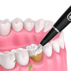 Ultrasonic Tooth Cleaner