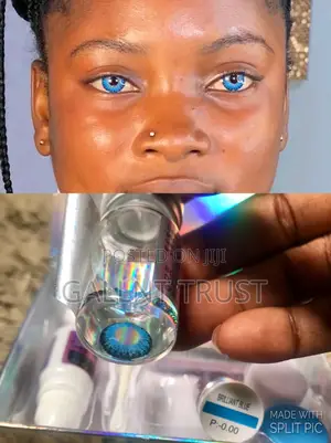 Contact Lens Kit