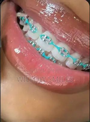 Removable Braces + Oral Care Set