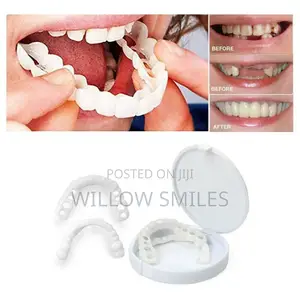 Snap on Veneers + 1 Box of Mouthwash Free Delivery in Accra