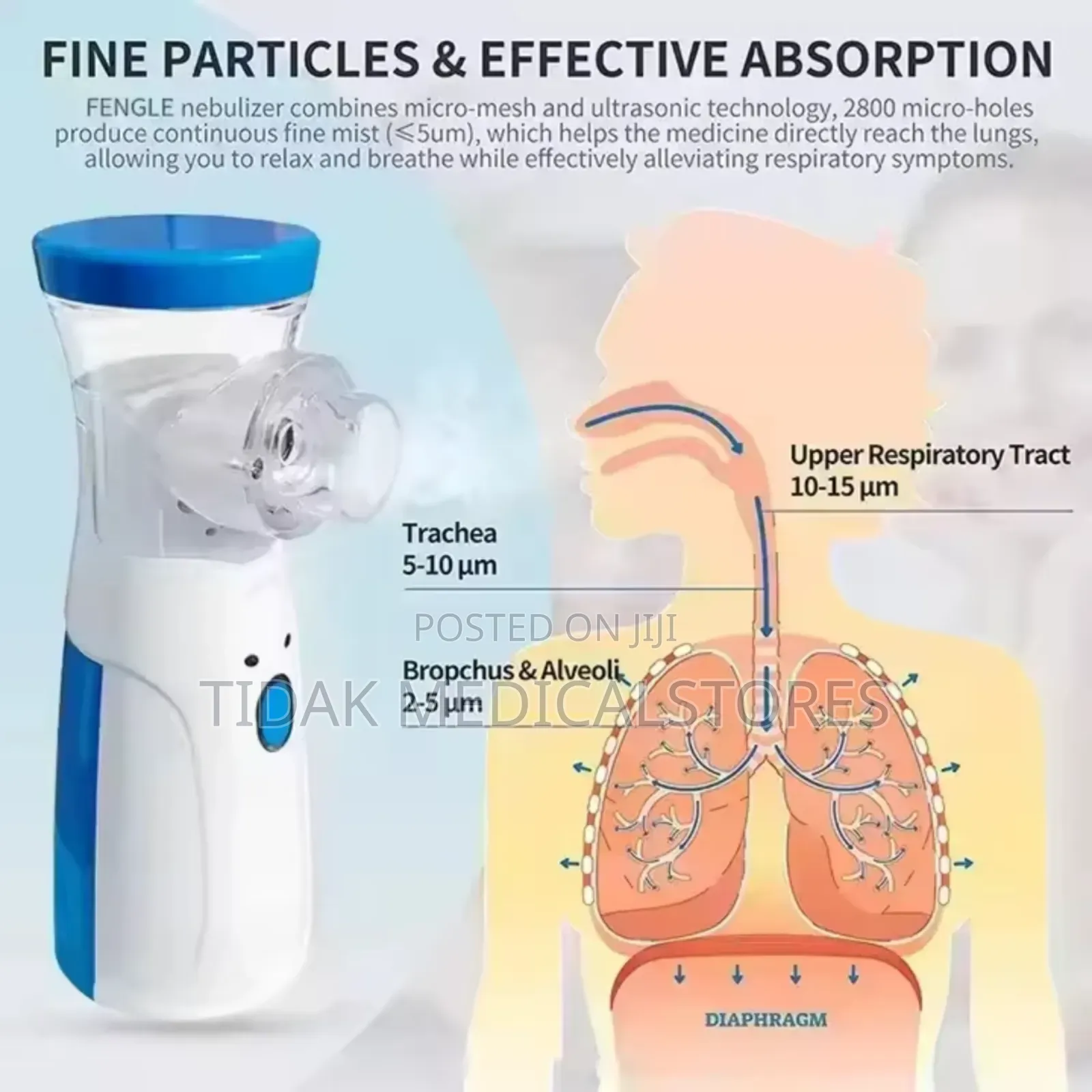 Nebulizer (Portable)