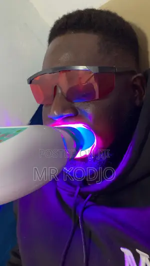Teeth Whitening Service