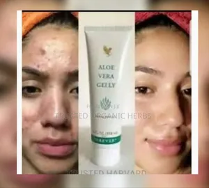 Natural Solution For Pimples Dark Spots And Acne