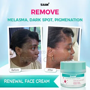 Saam Renewal Cream