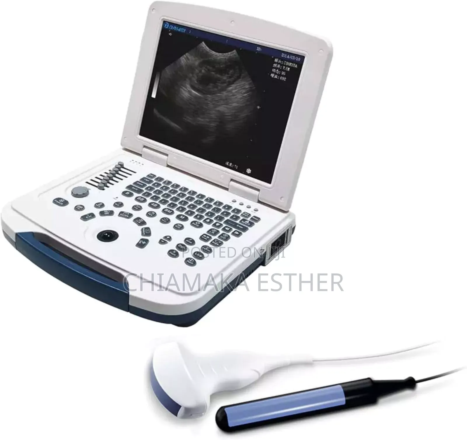 Ultrasound Scan Machine Table Top