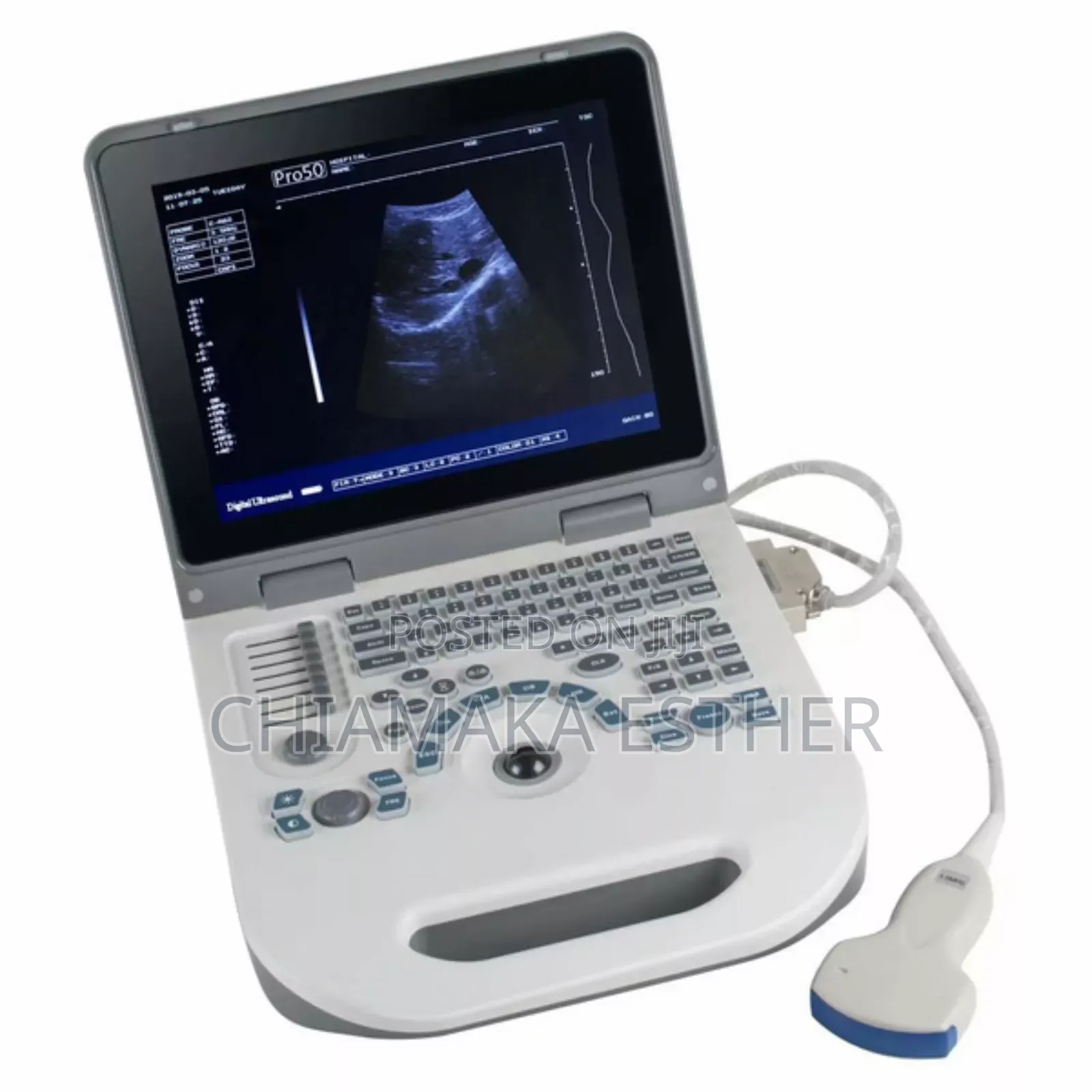 Ultrasound Scan Machine Table Top
