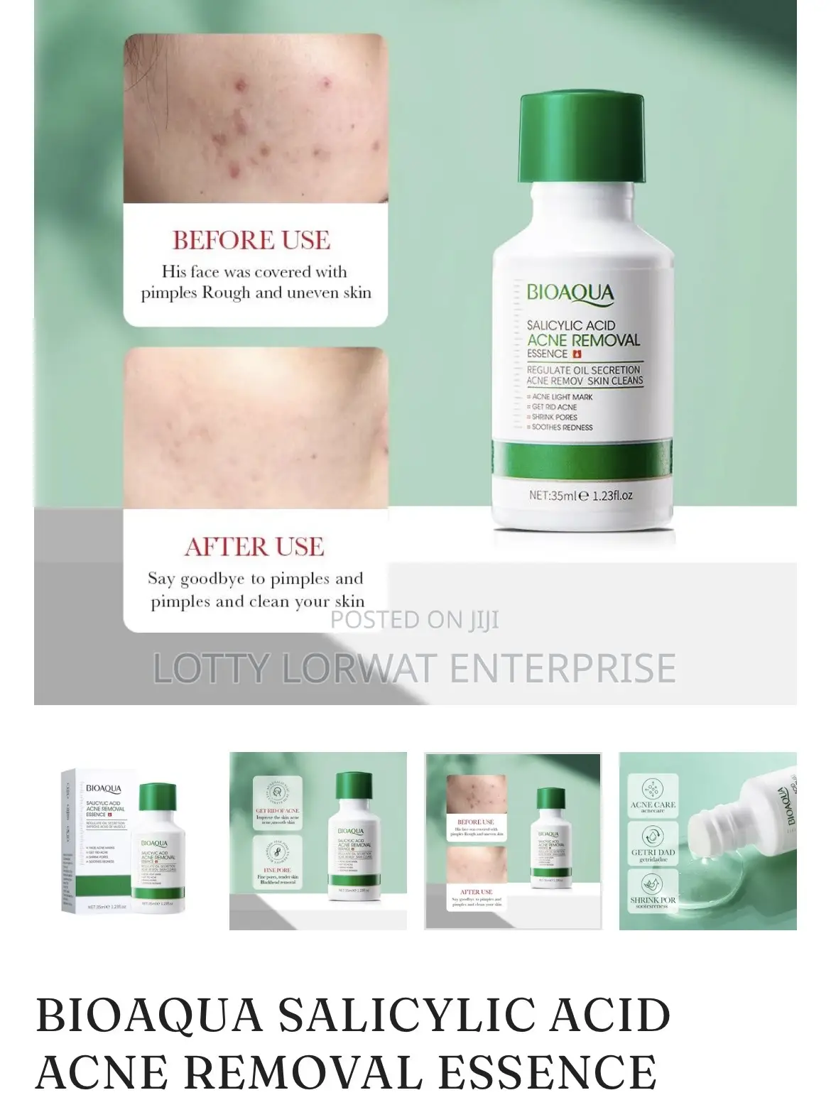 Acne Removal Set