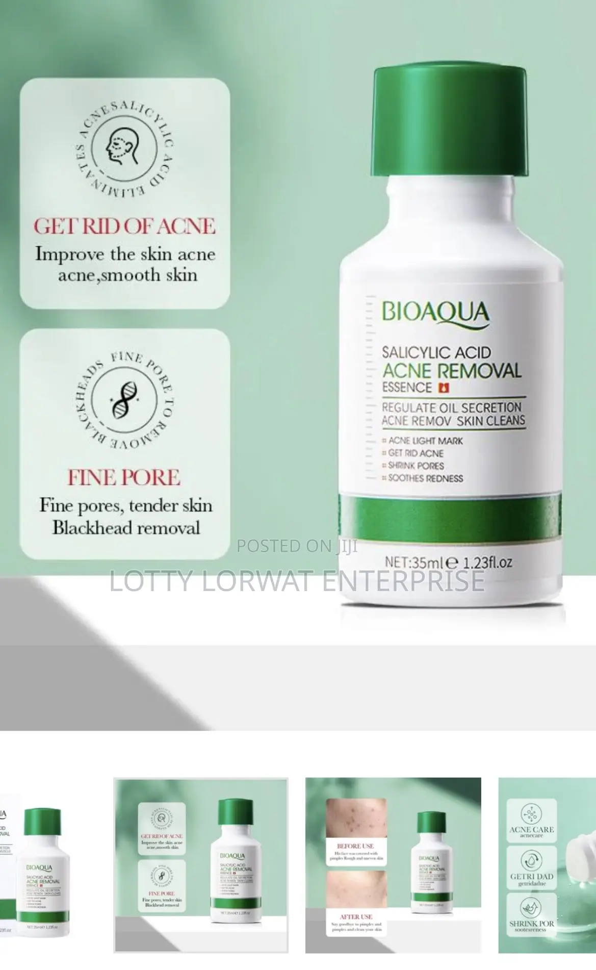 Acne Removal Set