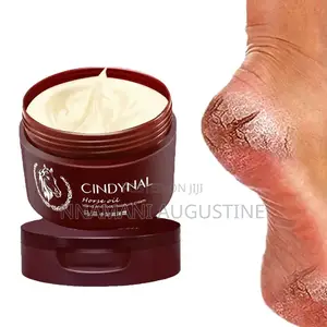 Foot Peel Remover Cream