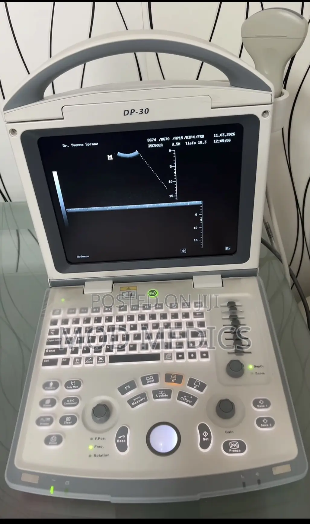 Mindray Dp30