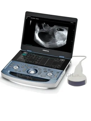 Mindray Dp 10 Ultrasound Scan Machine With Convex Probe