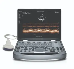 Mindray Dp10 Ultrasound Scan Machine