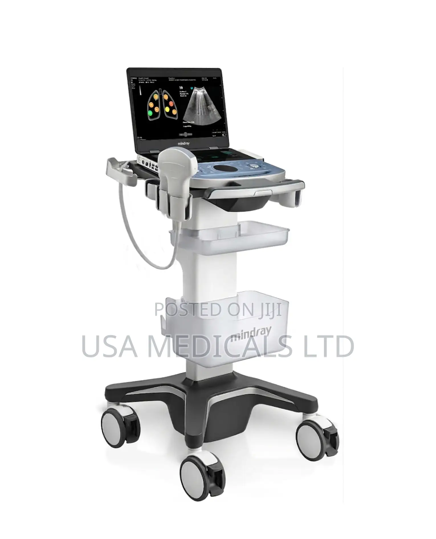 Mindray Dp10 Ultrasound Scan Machine With Probe and Trolley