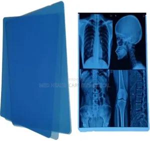 X-Ray Blue Films