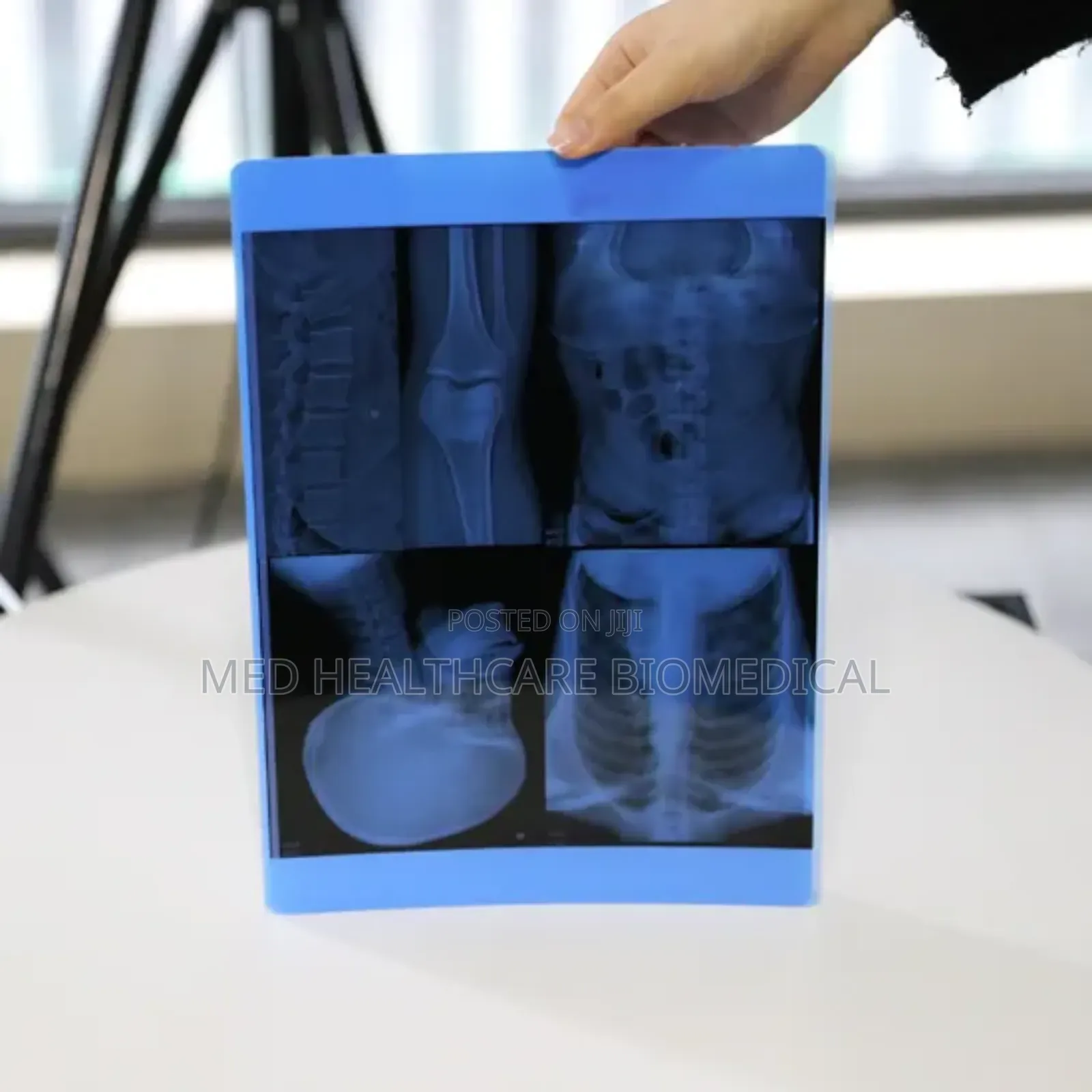 X-Ray Blue Films