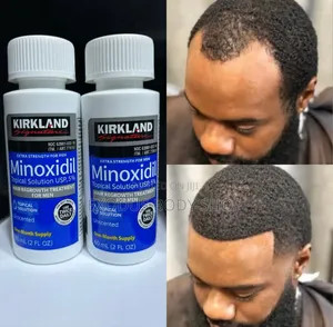 Kirkland Minoxidil Hair Regrowth Oil for Baldness Treatment (Costco)