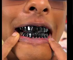 Hip Hop Teeth Grillz