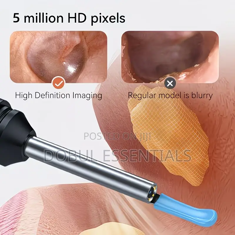 Ear Cleaner With Wireless Camera Compatible With Android And Ios