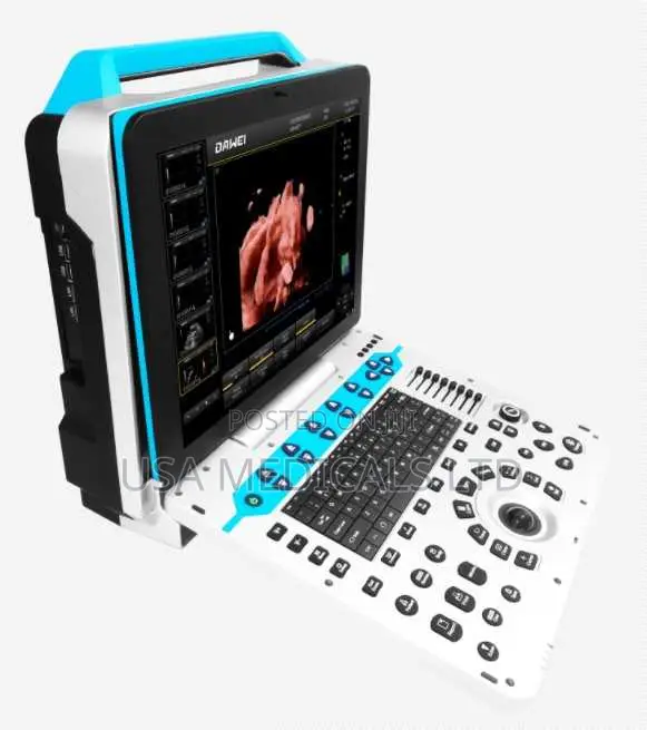 Color Doppler Ultrasound Scan Machine( Dawei )