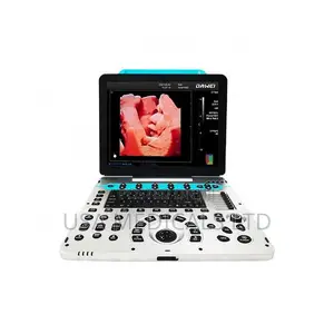 Color Doppler Ultrasound Scan Machine( Dawei )