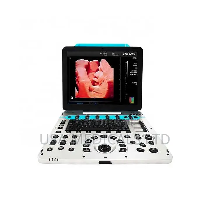Color Doppler Ultrasound Scan Machine( Dawei )