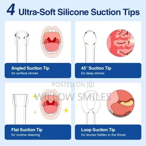 Tonsil Stone Remover