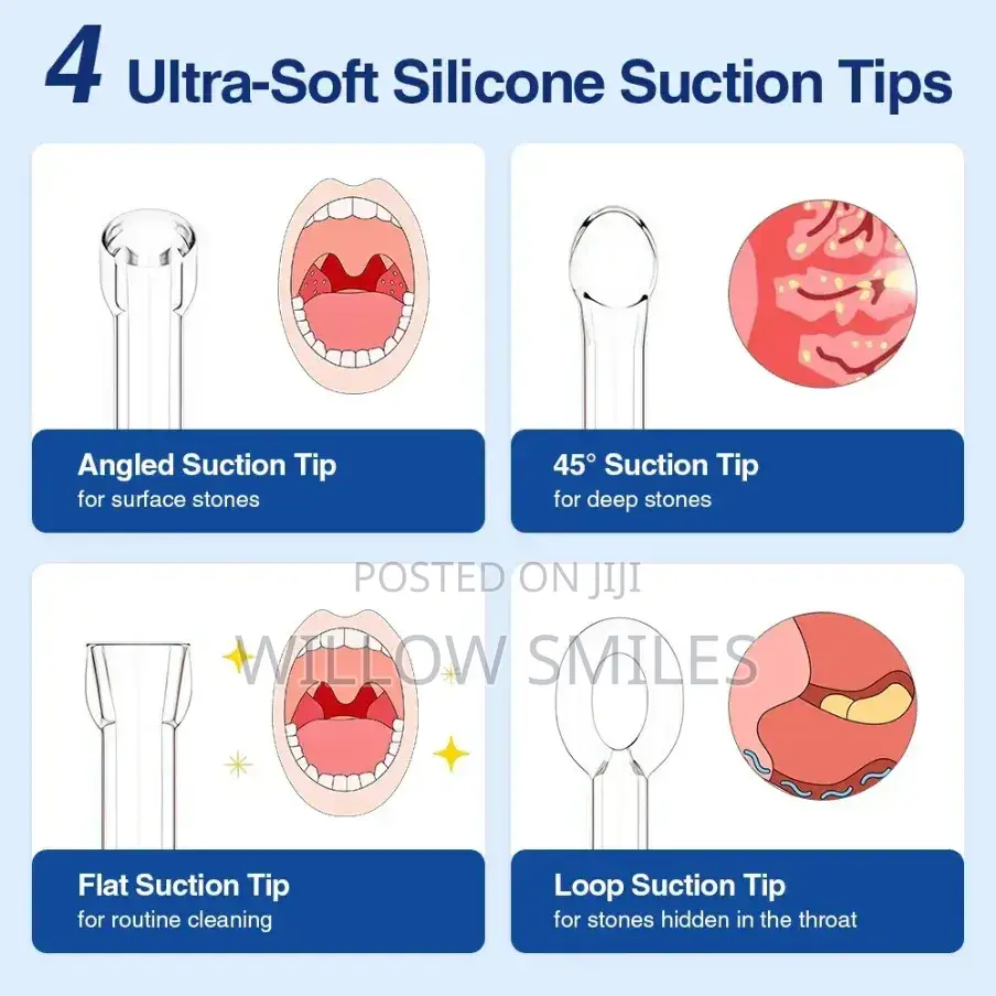 Tonsil Stone Remover
