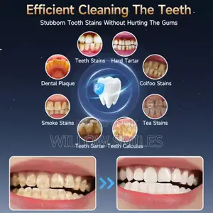 Electric Teeth Cleaner + Tooth Brush + Stand + Teeth Polishing Paste