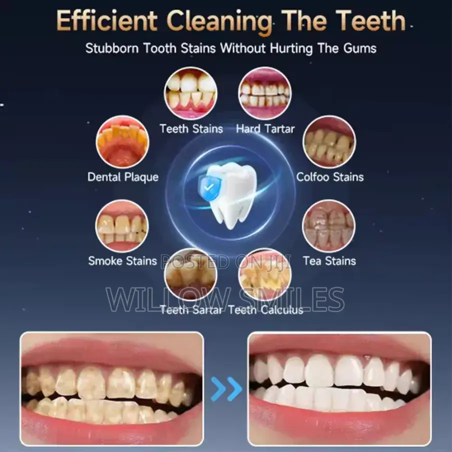 Electric Teeth Cleaner + Tooth Brush + Stand + Teeth Polishing Paste