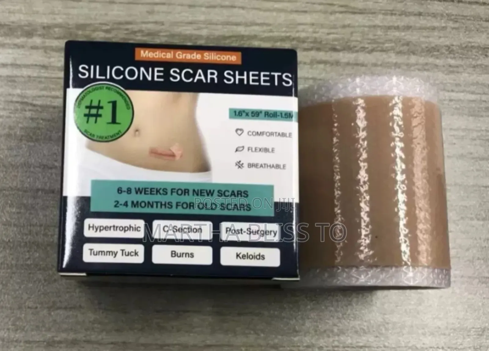 Silicone Scar Sheet