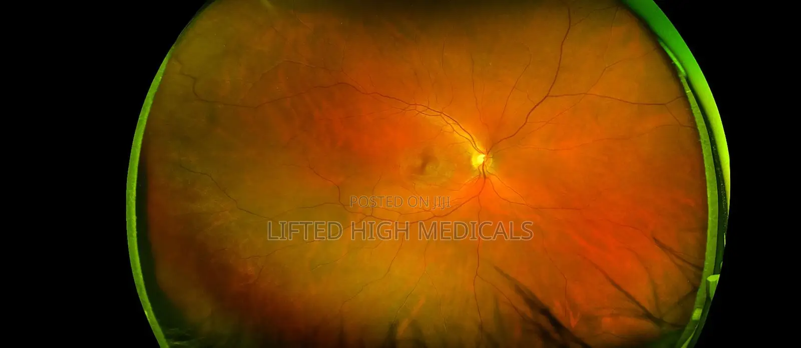 Topcon TRC-50dx Fundus Camera – Retinal Imaging System