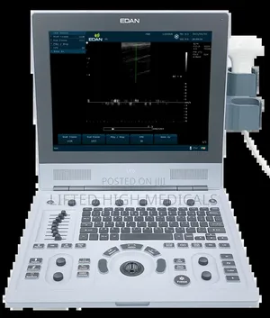 Edan U60 Color Doppler Ultrasound Machine